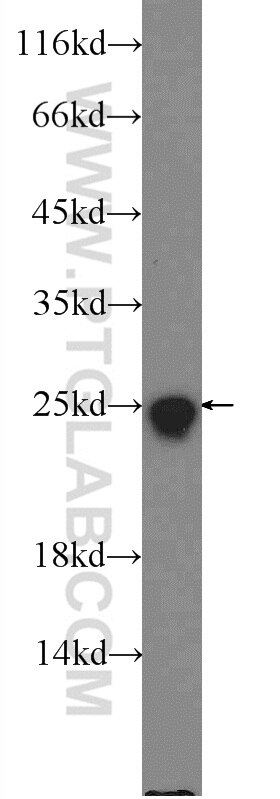 SOD2 Polyclonal antibody