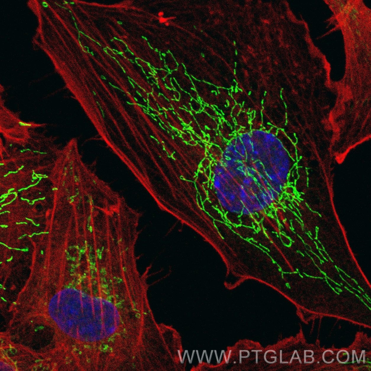Immunofluorescence (IF) / fluorescent staining of HUVEC cells using SOD2 Monoclonal antibody (66474-1-Ig)