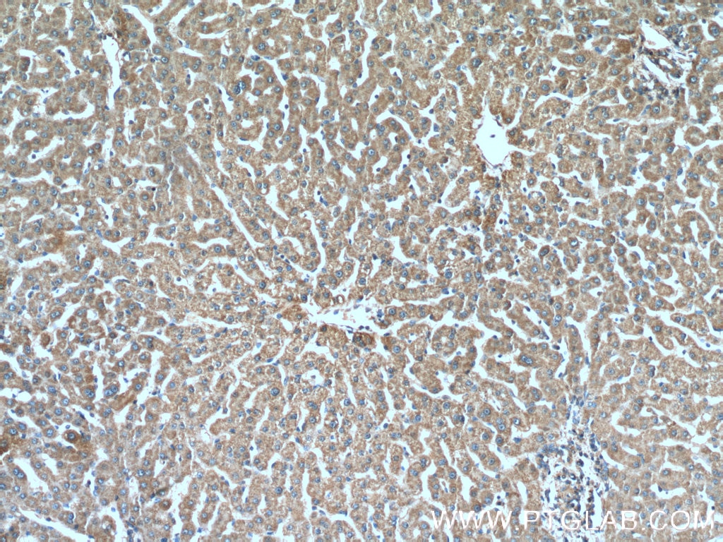Immunohistochemistry (IHC) staining of human liver tissue using SOD2 Monoclonal antibody (66474-1-Ig)