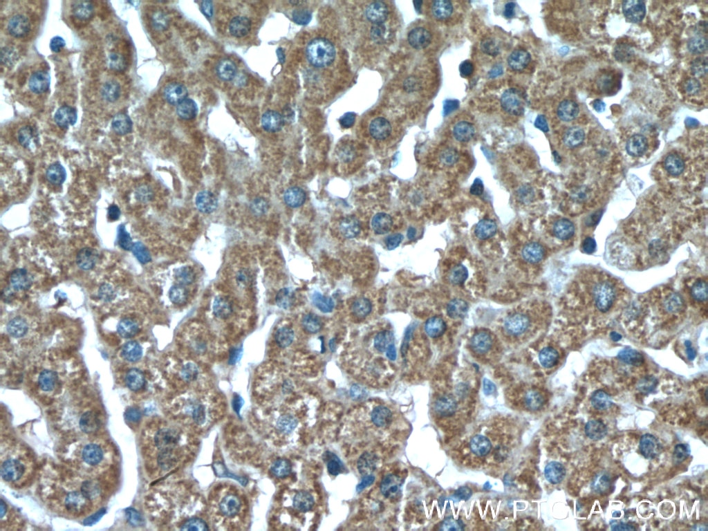 Immunohistochemistry (IHC) staining of human liver tissue using SOD2 Monoclonal antibody (66474-1-Ig)