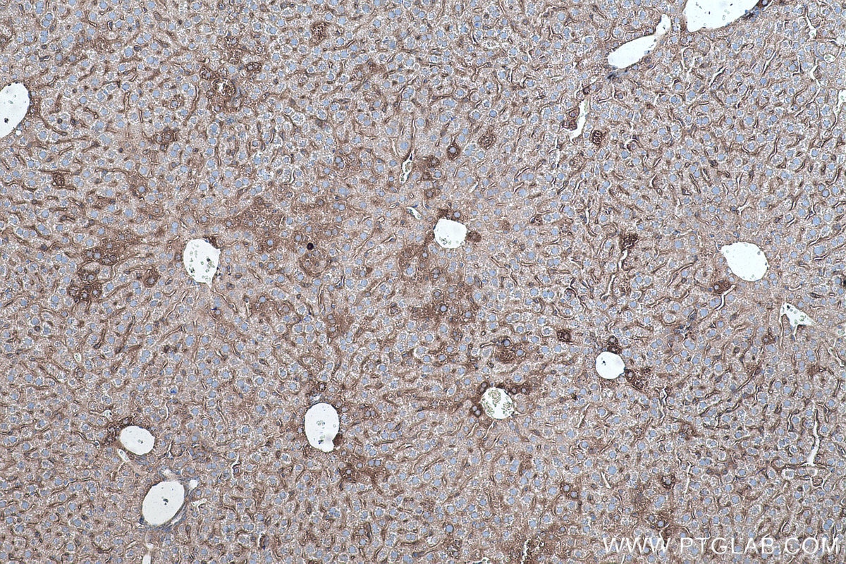 Immunohistochemistry (IHC) staining of mouse liver tissue using SOD2 Monoclonal antibody (66474-1-Ig)
