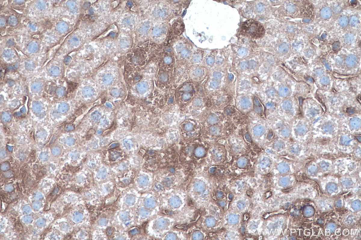 Immunohistochemistry (IHC) staining of mouse liver tissue using SOD2 Monoclonal antibody (66474-1-Ig)