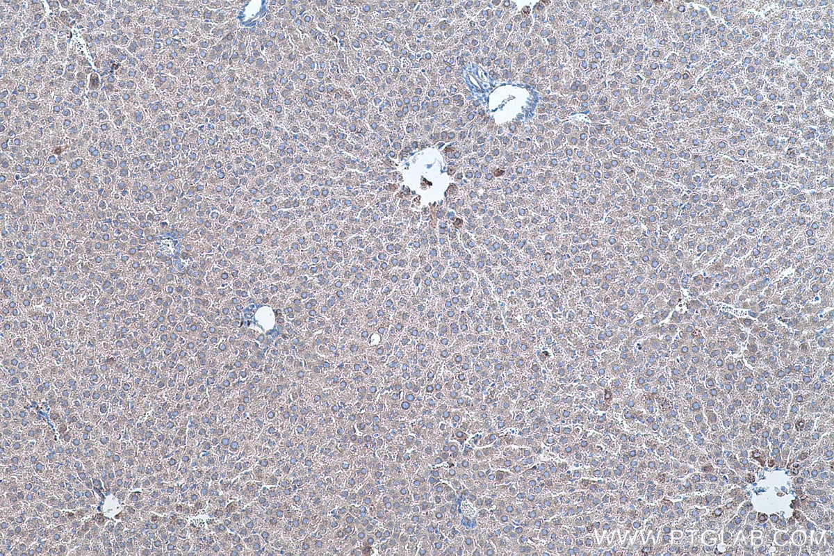 Immunohistochemistry (IHC) staining of rat liver tissue using SOD2 Monoclonal antibody (66474-1-Ig)