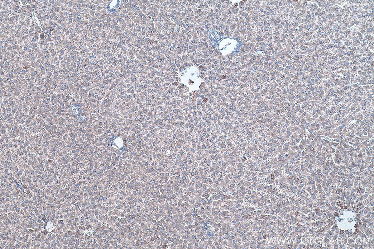 IHC staining of rat liver using 66474-1-Ig