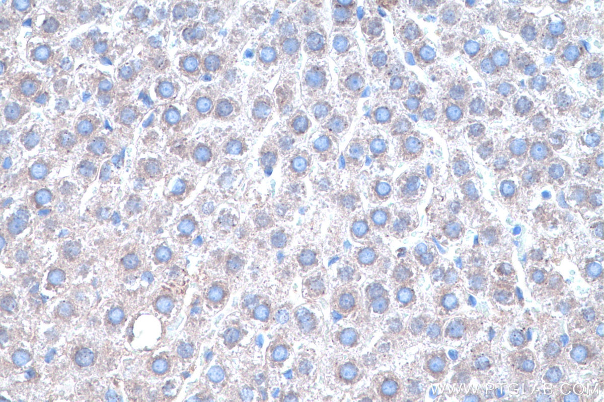 Immunohistochemistry (IHC) staining of rat liver tissue using SOD2 Monoclonal antibody (66474-1-Ig)