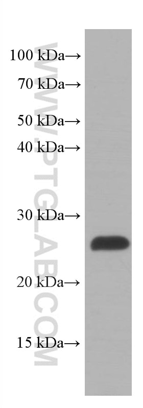 Western Blot (WB) analysis of HeLa cells using SOD2 Monoclonal antibody (66474-1-Ig)