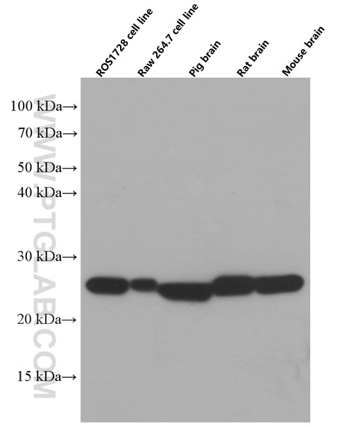 Western Blot (WB) analysis of various lysates using SOD2 Monoclonal antibody (66474-1-Ig)