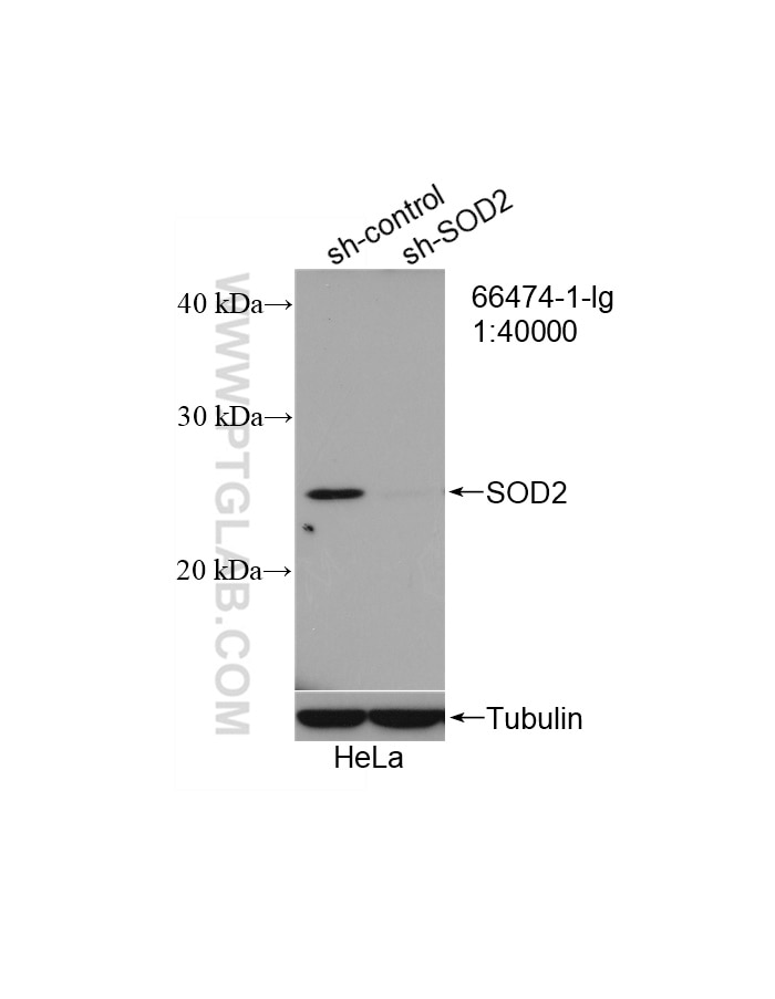Western Blot (WB) analysis of HeLa cells using SOD2 Monoclonal antibody (66474-1-Ig)