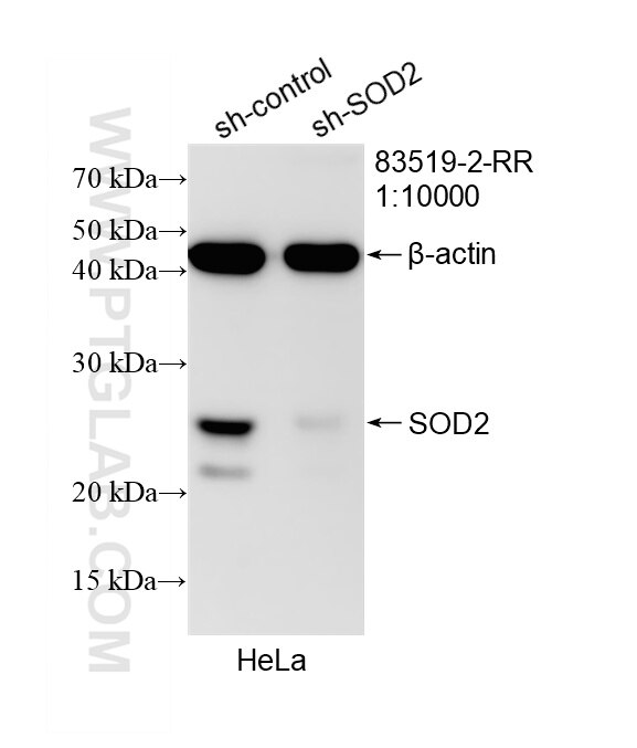 Western Blot (WB) analysis of HeLa cells using SOD2 Recombinant monoclonal antibody (83519-2-RR)
