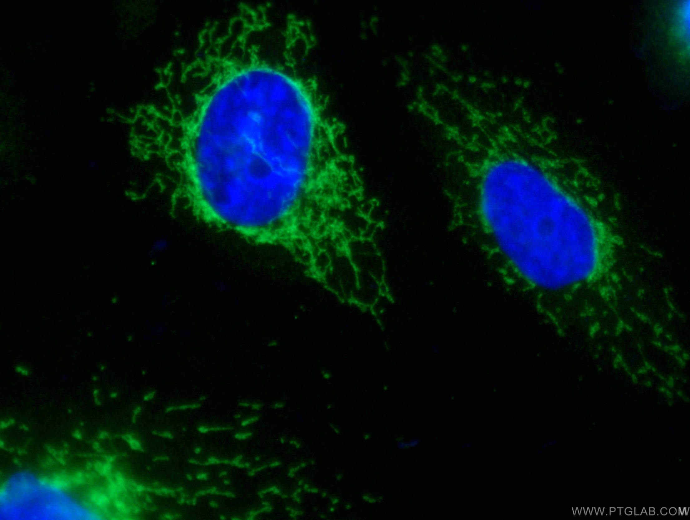 Immunofluorescence (IF) / fluorescent staining of HUVEC cells using CoraLite® Plus 488-conjugated SOD2 Monoclonal anti (CL488-66474)