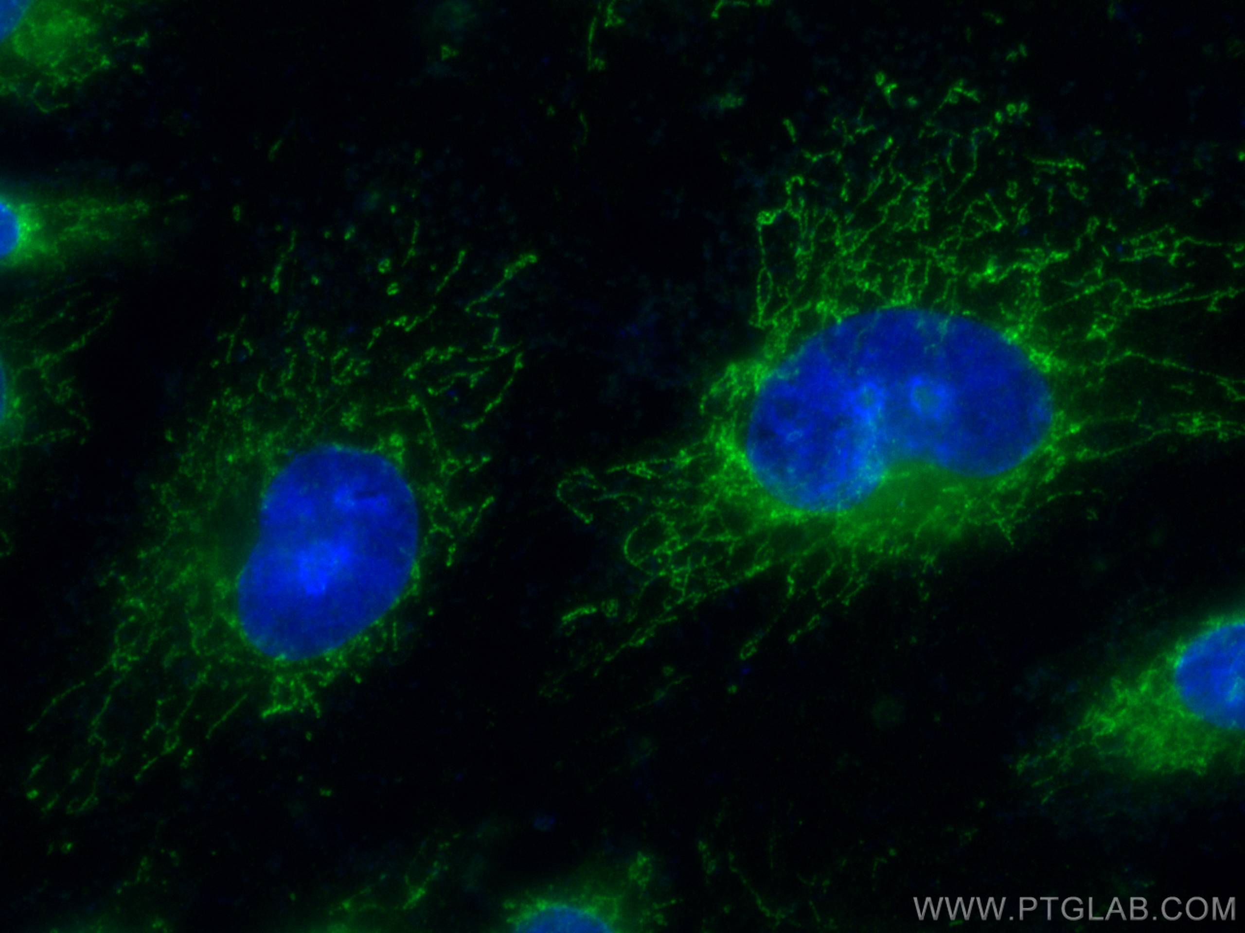 Immunofluorescence (IF) / fluorescent staining of HUVEC cells using CoraLite® Plus 488-conjugated SOD2 Monoclonal anti (CL488-66474)