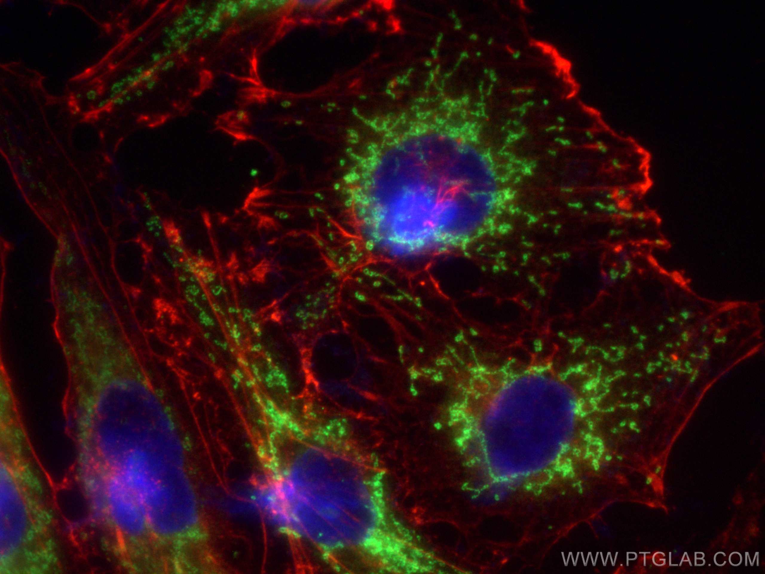 Immunofluorescence (IF) / fluorescent staining of HUVEC cells using CoraLite® Plus 488-conjugated SOD2 Monoclonal anti (CL488-66474)
