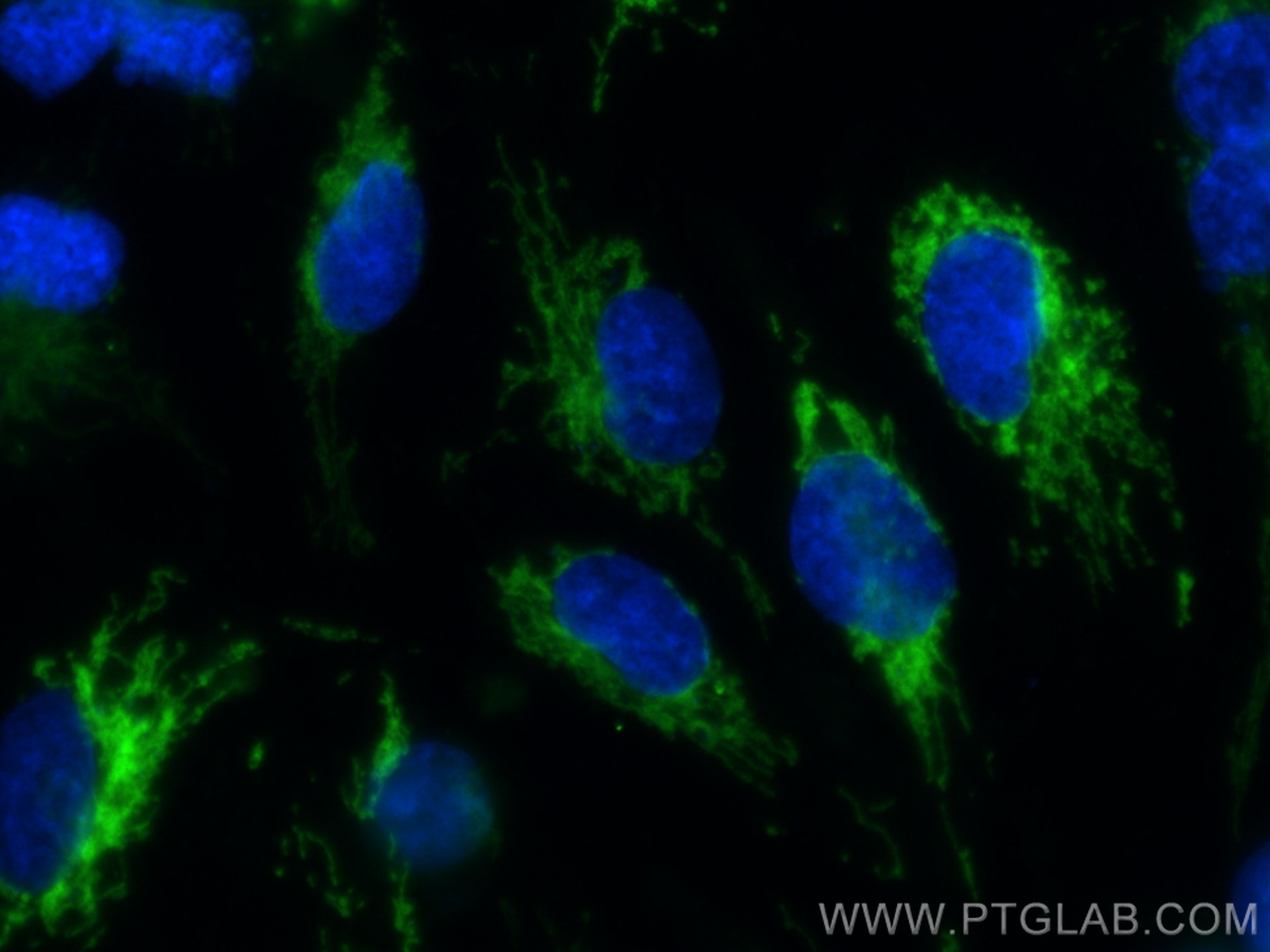 Immunofluorescence (IF) / fluorescent staining of HUVEC cells using CoraLite® Plus 488-conjugated SOD2 Recombinant ant (CL488-83519-3)