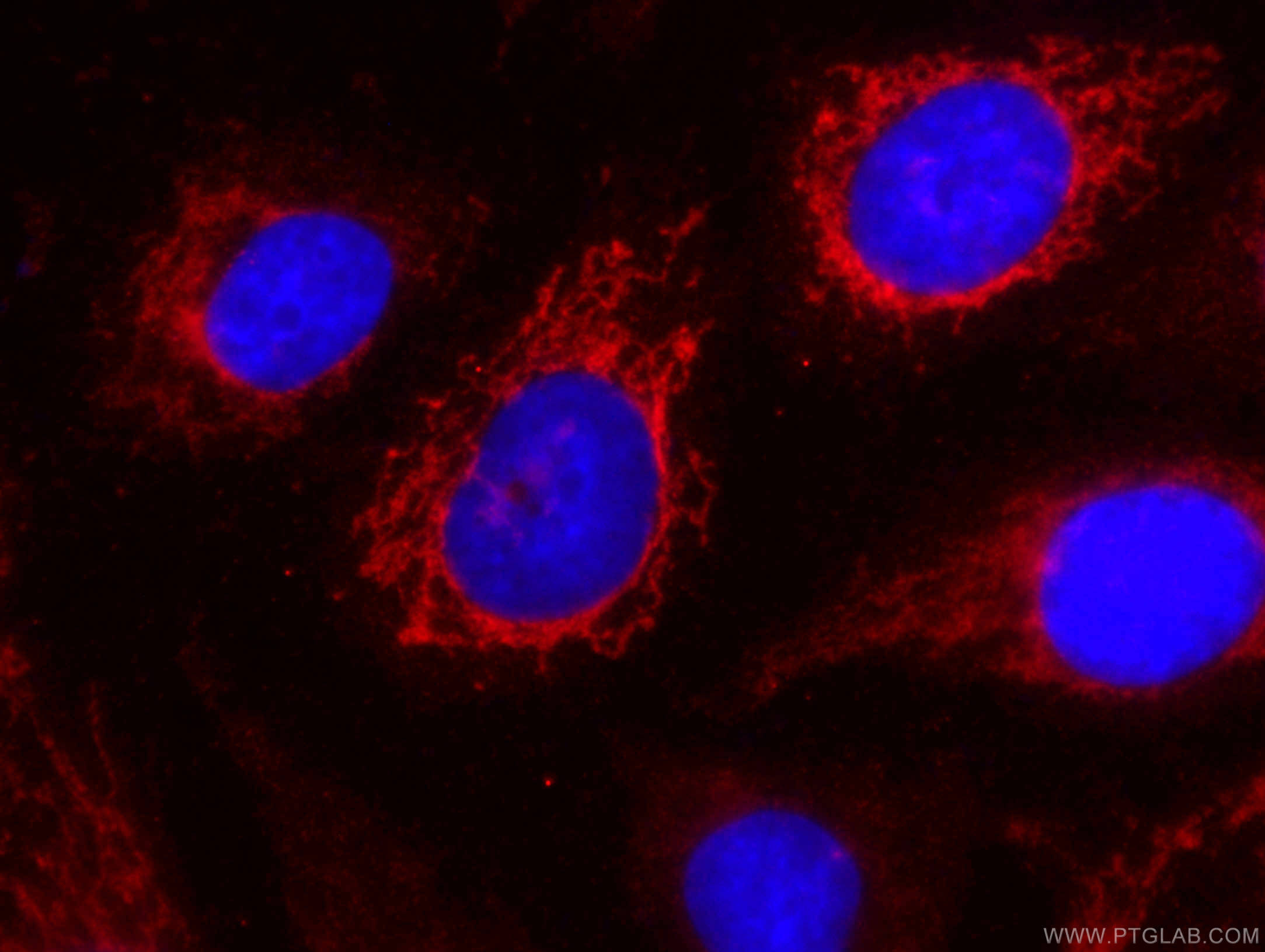 Immunofluorescence (IF) / fluorescent staining of HUVEC cells using CoraLite®594-conjugated SOD2 Monoclonal antibody (CL594-66474)