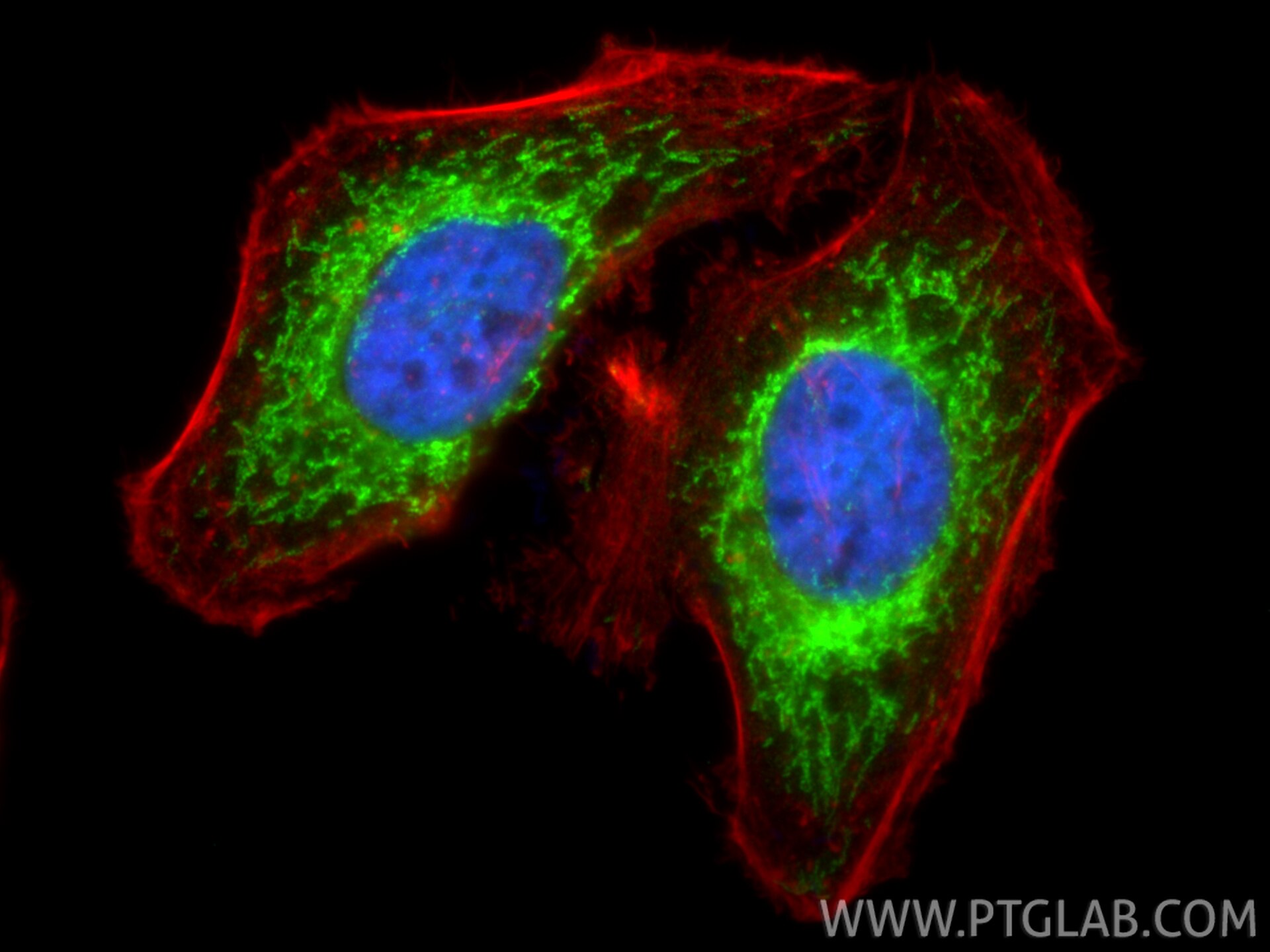 IF Staining of HeLa using RMX00079 Immunofluorescence (IF) / fluorescent staining of HeLa cells using Multi-rAb® SOD2 Multi-Recombinant antibody (RMX00079)