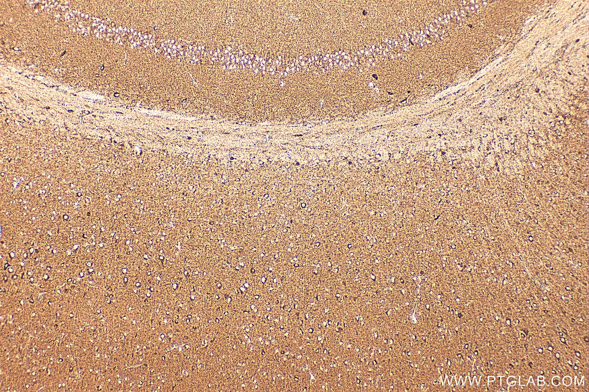 IHC staining of mouse brain using RMX00079 Immunohistochemistry (IHC) staining of mouse brain tissue using Multi-rAb® SOD2 Multi-Recombinant antibody (RMX00079)