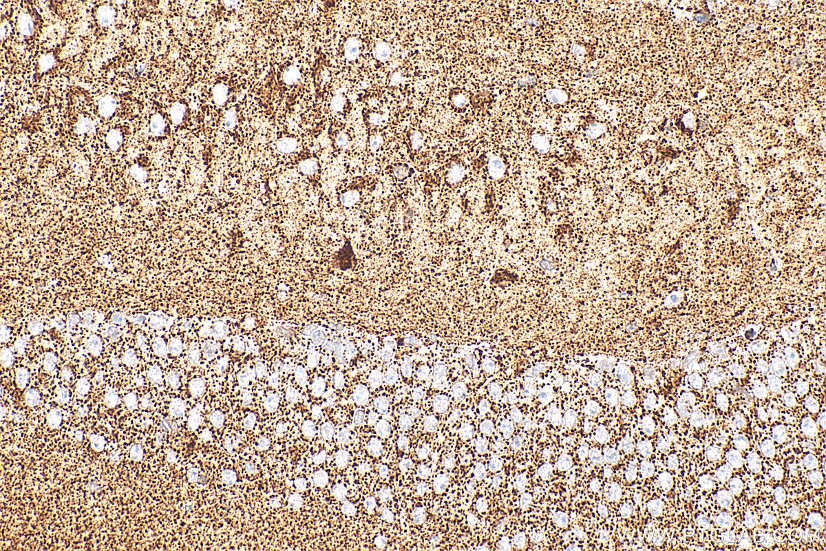 IHC staining of mouse brain using RMX00079 Immunohistochemistry (IHC) staining of mouse brain tissue using Multi-rAb® SOD2 Multi-Recombinant antibody (RMX00079)