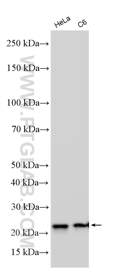 WB analysis using RMX00079 Western Blot (WB) analysis of various lysates using Multi-rAb® SOD2 Multi-Recombinant antibody (RMX00079)