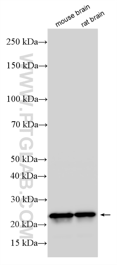 WB analysis using RMX00079 Western Blot (WB) analysis of various lysates using Multi-rAb® SOD2 Multi-Recombinant antibody (RMX00079)