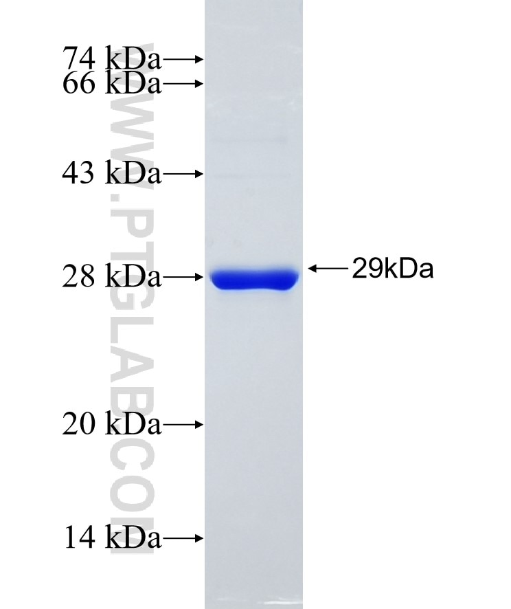 SOD2 fusion protein Ag21388 SDS-PAGE