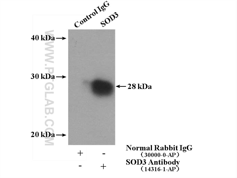 Immunoprecipitation (IP) experiment of human placenta tissue using SOD3 Polyclonal antibody (14316-1-AP)