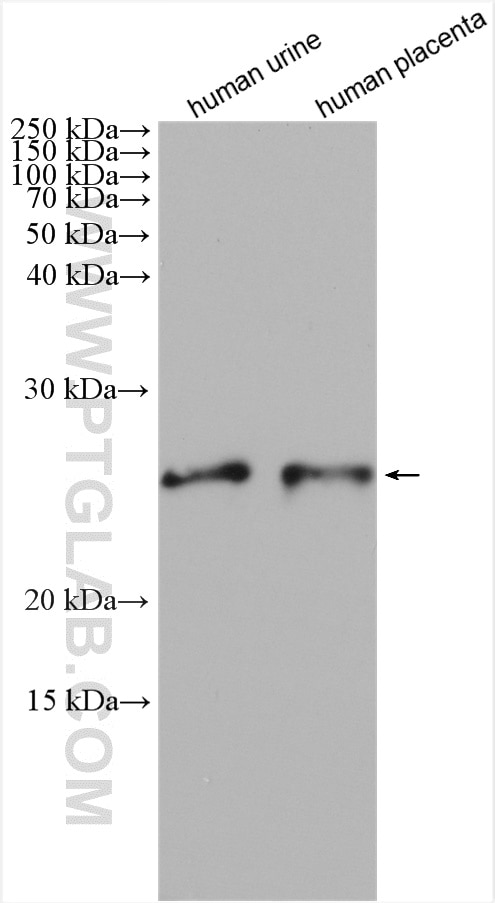 Western Blot (WB) analysis of various lysates using SOD3 Polyclonal antibody (14316-1-AP)