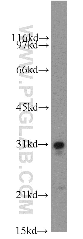 Western Blot (WB) analysis of human heart tissue using SOD3 Polyclonal antibody (14316-1-AP)