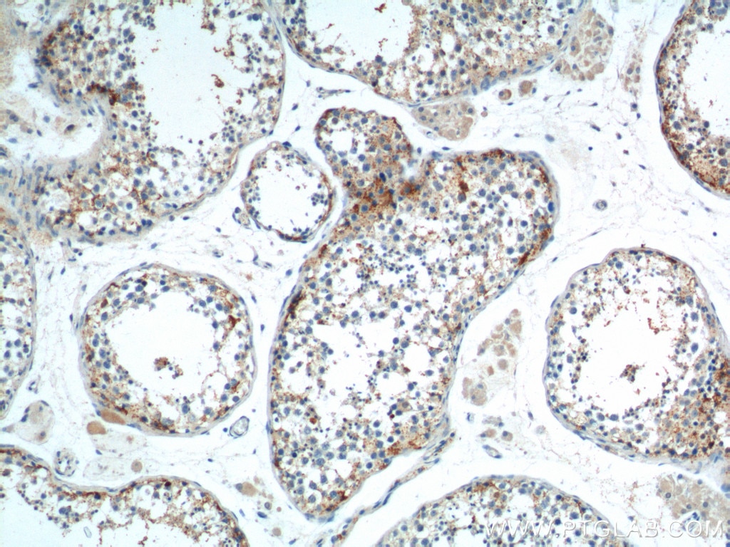 Immunohistochemistry (IHC) staining of human testis tissue using SOHLH1 Polyclonal antibody (17753-1-AP)