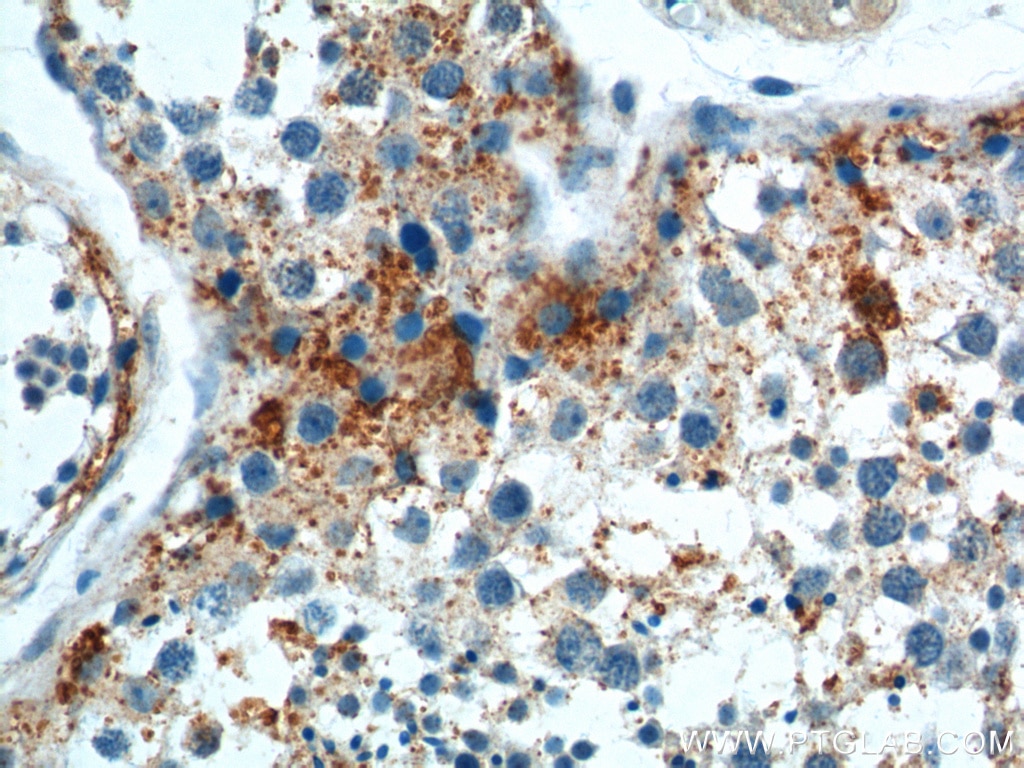 Immunohistochemistry (IHC) staining of human testis tissue using SOHLH1 Polyclonal antibody (17753-1-AP)