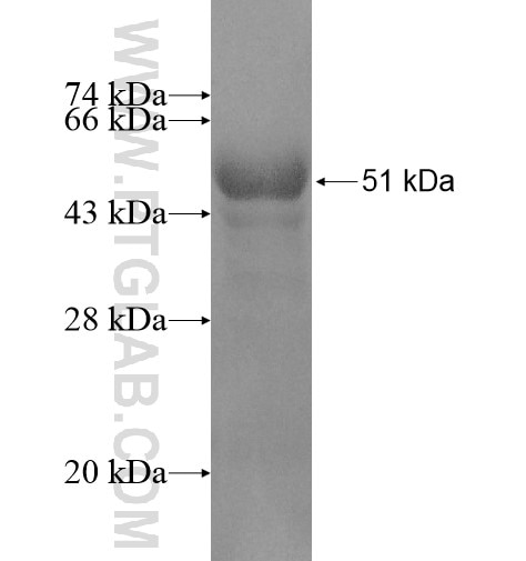SOHLH2 fusion protein Ag10768 SDS-PAGE
