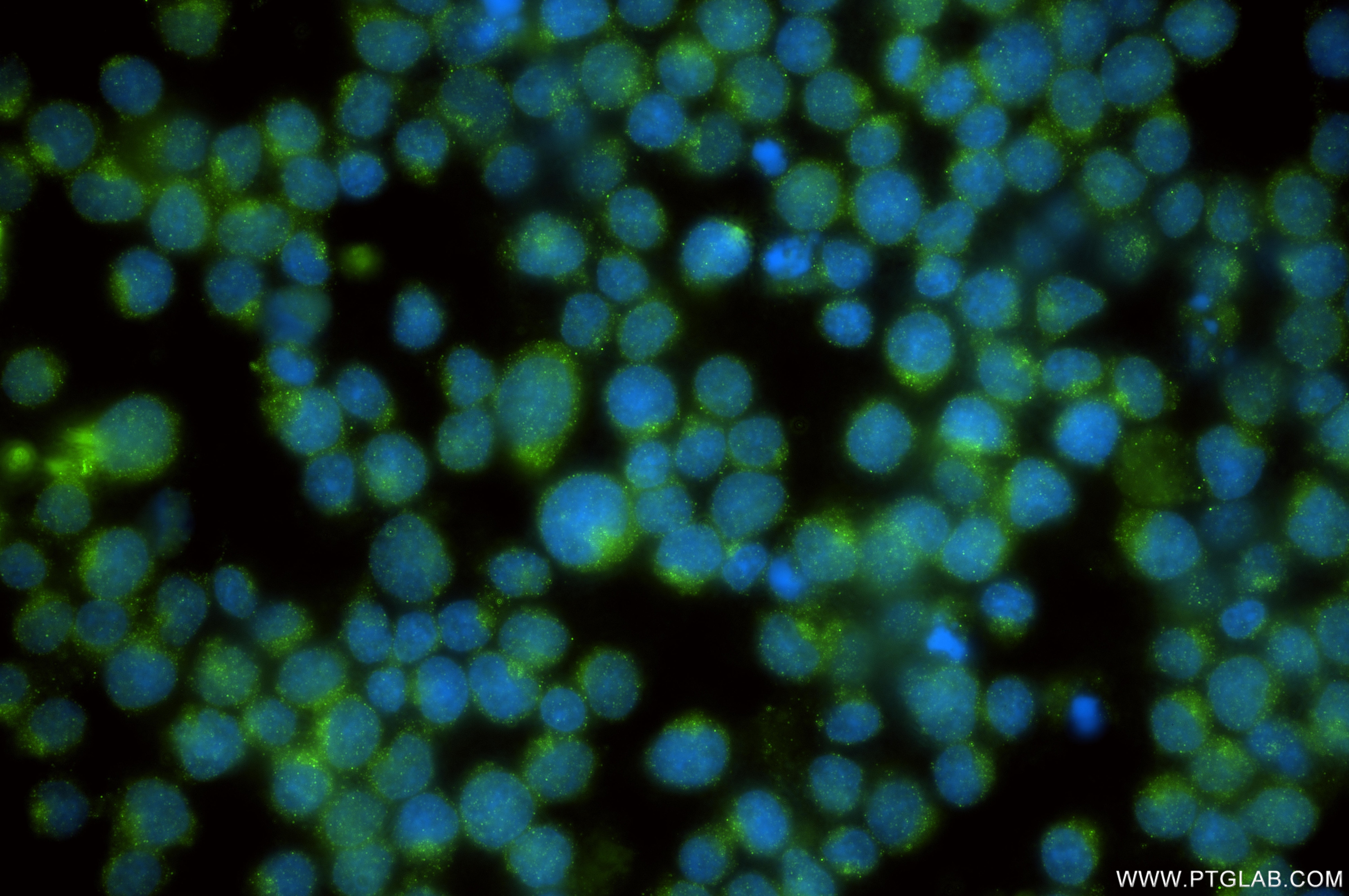 Immunofluorescence (IF) / fluorescent staining of Jurkat cells using SOLO/SESTD1 Recombinant monoclonal antibody (86875-2-RR)