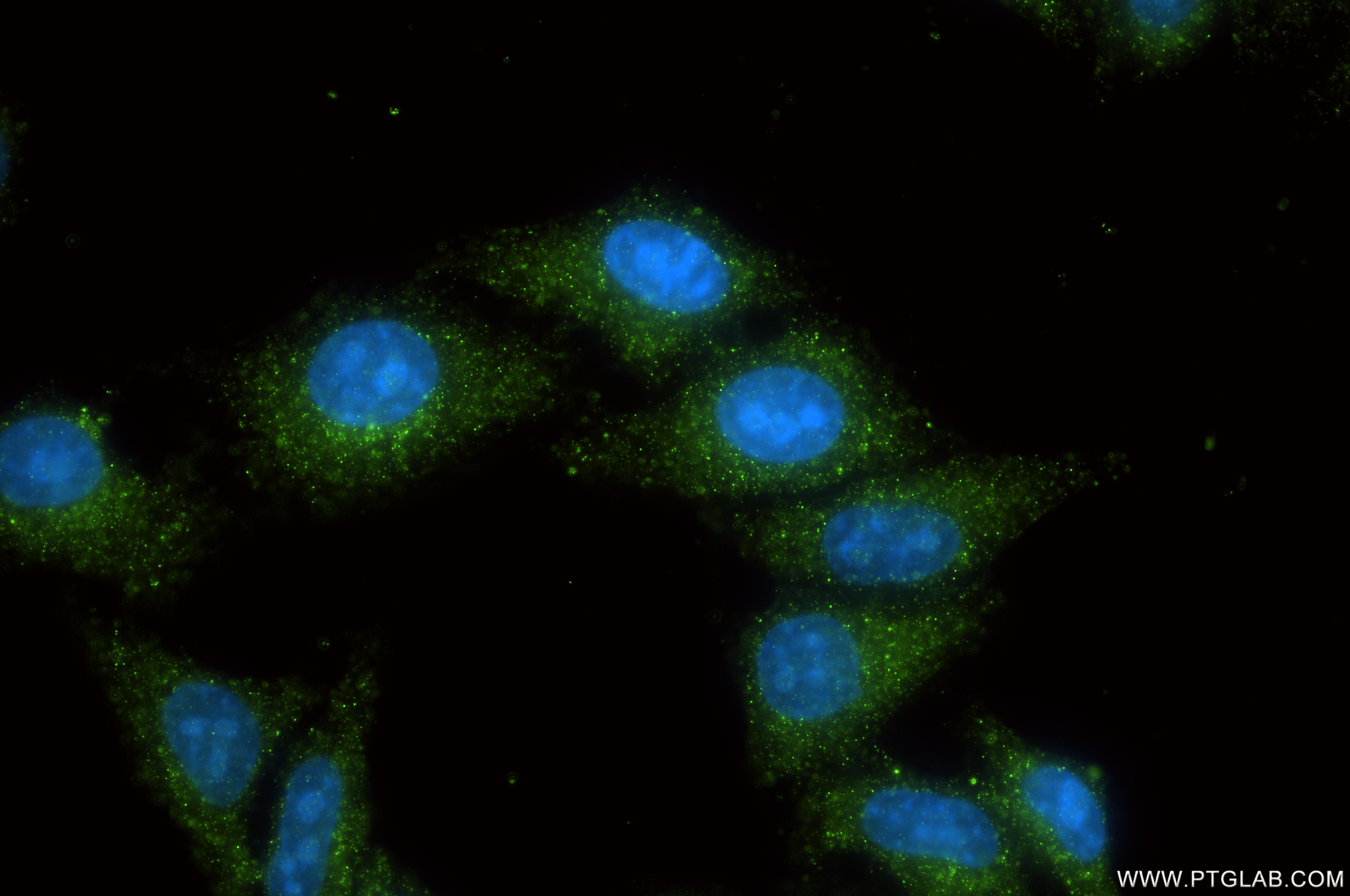 Immunofluorescence (IF) / fluorescent staining of HepG2 cells using SOLO/SESTD1 Recombinant monoclonal antibody (86875-2-RR)