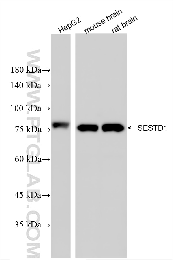 Western Blot (WB) analysis of various lysates using SOLO/SESTD1 Recombinant monoclonal antibody (86875-2-RR)