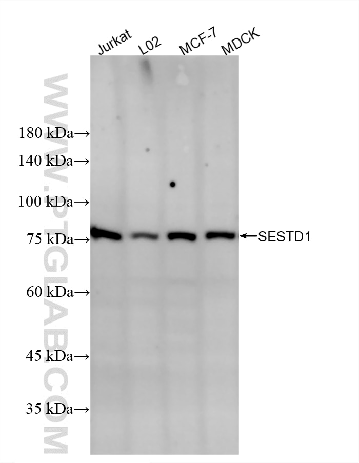 Western Blot (WB) analysis of various lysates using SOLO/SESTD1 Recombinant monoclonal antibody (86875-2-RR)