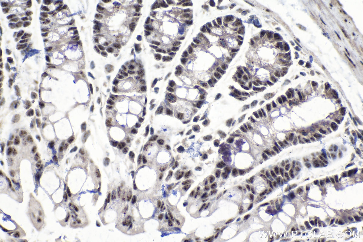 Immunohistochemistry (IHC) staining of mouse colon tissue using SON Polyclonal antibody (28046-1-AP)