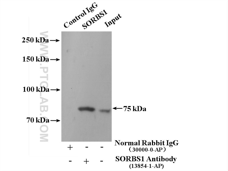 Immunoprecipitation (IP) experiment of mouse liver tissue using SORBS1 Polyclonal antibody (13854-1-AP)