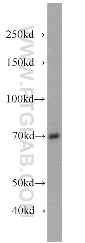 Western Blot (WB) analysis of mouse liver tissue using SORBS1 Polyclonal antibody (13854-1-AP)