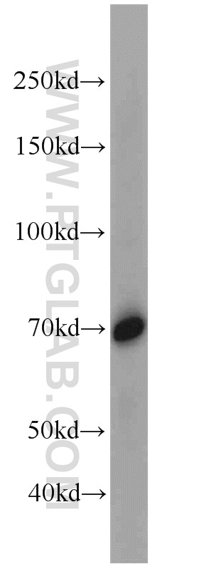 Western Blot (WB) analysis of mouse kidney tissue using SORBS1 Polyclonal antibody (13854-1-AP)