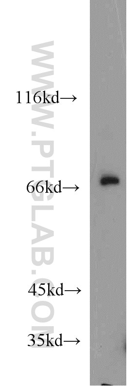 Western Blot (WB) analysis of mouse kidney tissue using SORBS1 Polyclonal antibody (13854-1-AP)
