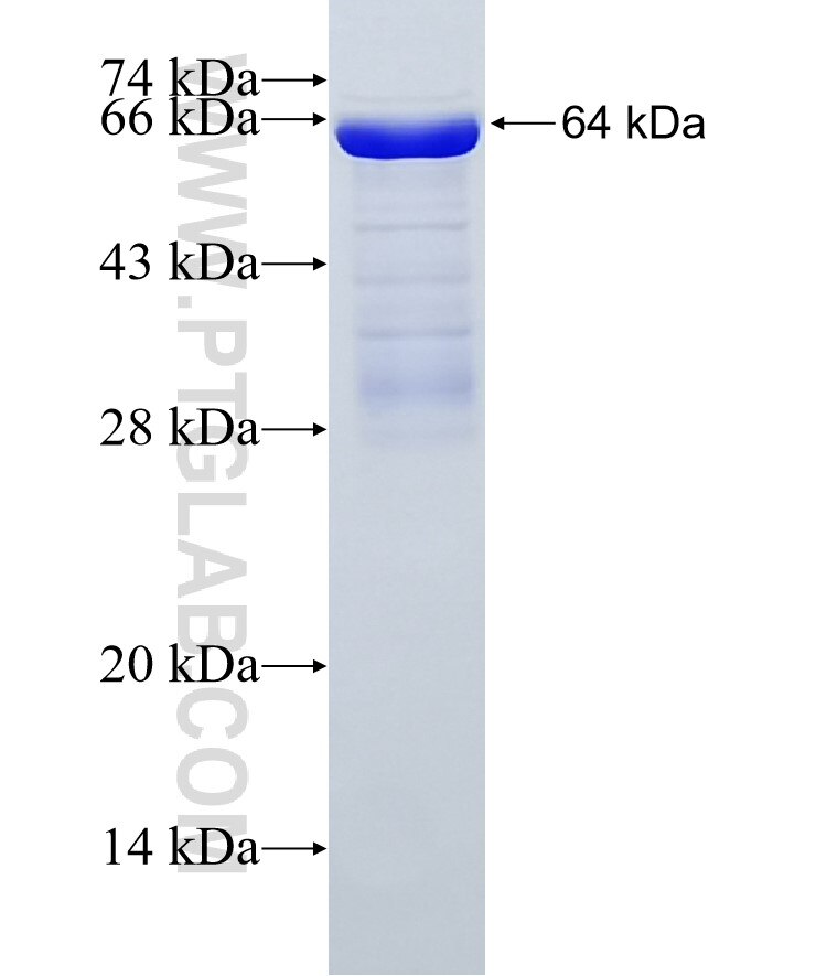 SORBS1 fusion protein Ag4828 SDS-PAGE