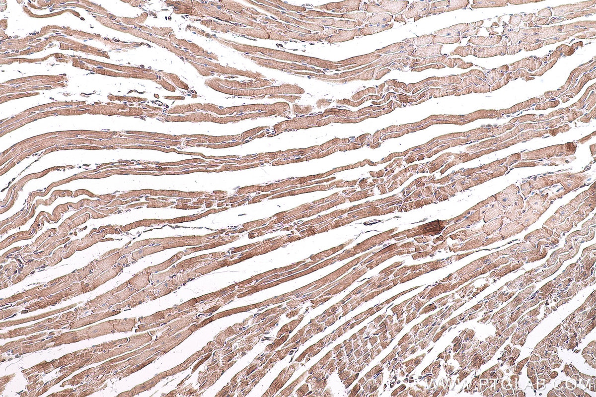 Immunohistochemistry (IHC) staining of mouse heart tissue using SORBS2 Polyclonal antibody (24643-1-AP)