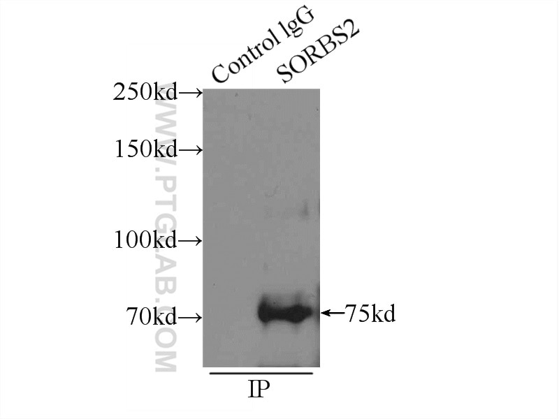 Immunoprecipitation (IP) experiment of mouse heart tissue using SORBS2 Polyclonal antibody (24643-1-AP)