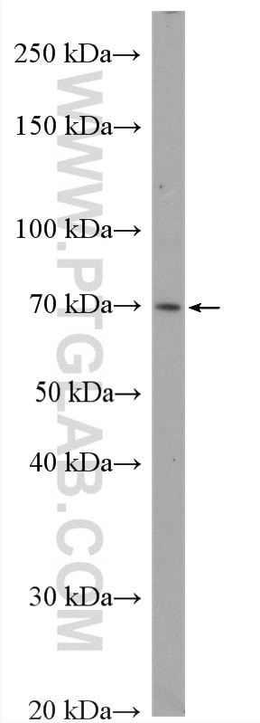 Western Blot (WB) analysis of U-251 cells using SORBS2 Polyclonal antibody (24643-1-AP)