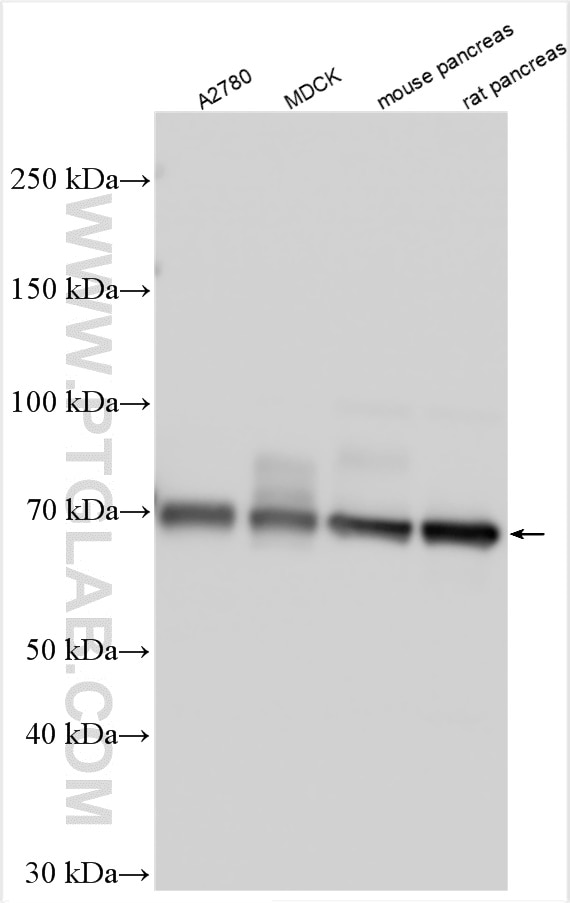 Western Blot (WB) analysis of various lysates using SORBS2 Polyclonal antibody (24643-1-AP)