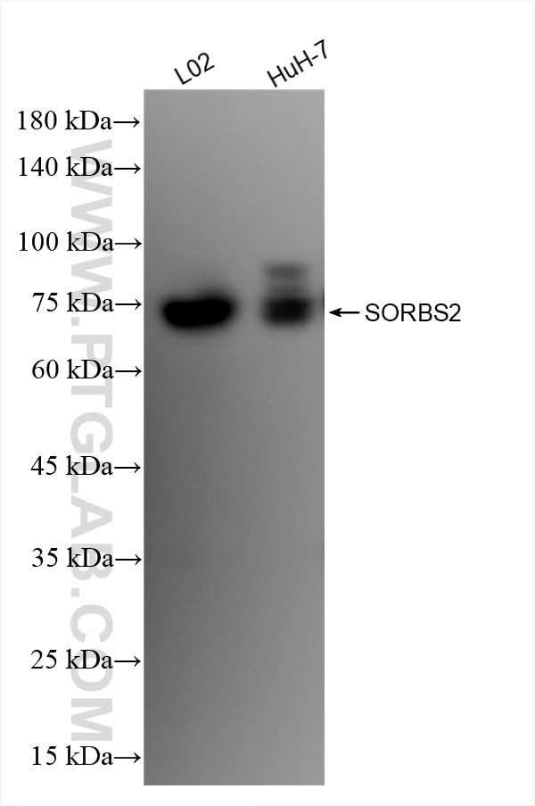 Western Blot (WB) analysis of various lysates using SORBS2 Recombinant antibody (83189-3-RR)