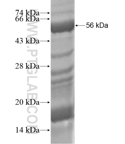 SORBS2 fusion protein Ag20041 SDS-PAGE