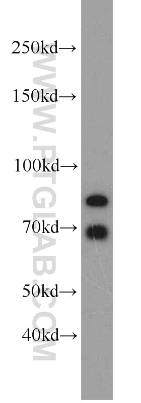 Western Blot (WB) analysis of mouse brain tissue using SORCS1 Polyclonal antibody (18839-1-AP)