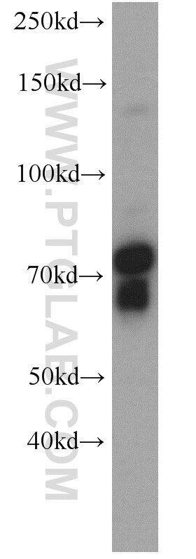 Western Blot (WB) analysis of Y79 cells using SORCS1 Polyclonal antibody (18839-1-AP)