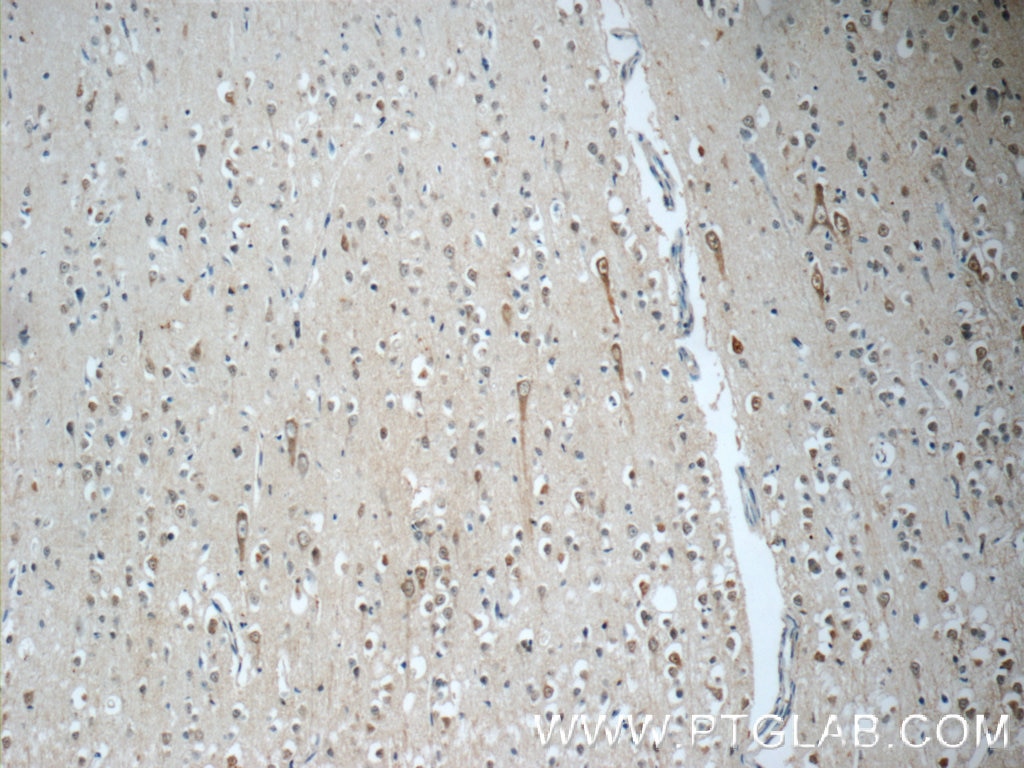 Immunohistochemistry (IHC) staining of human brain tissue using SORCS1 Polyclonal antibody (23002-1-AP)