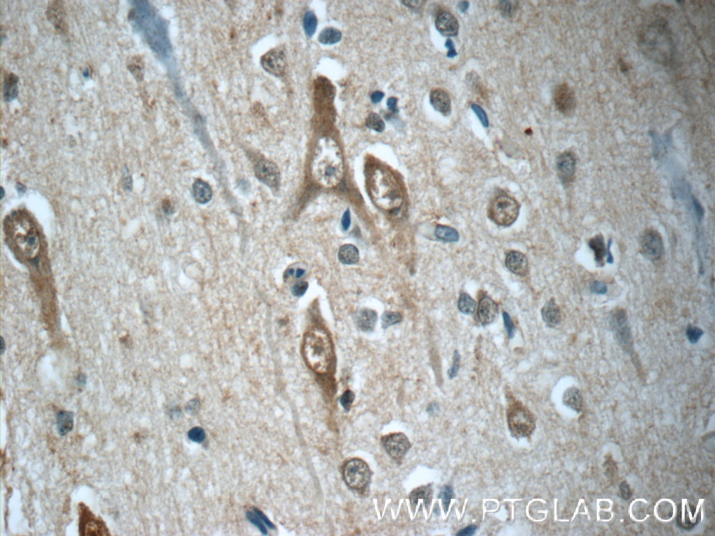 Immunohistochemistry (IHC) staining of human brain tissue using SORCS1 Polyclonal antibody (23002-1-AP)